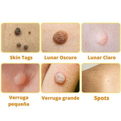 DERMABEE - TRATAMIENTO CON VENENO DE ABEJA PARA VERRUGAS Y MANCHAS