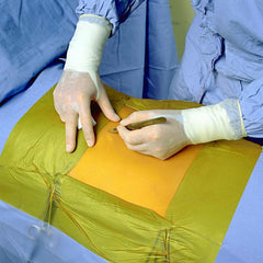 3M™ Ioban™ 2 Antimicrobial Incise Drape 10 x 10 cm Medvana UK